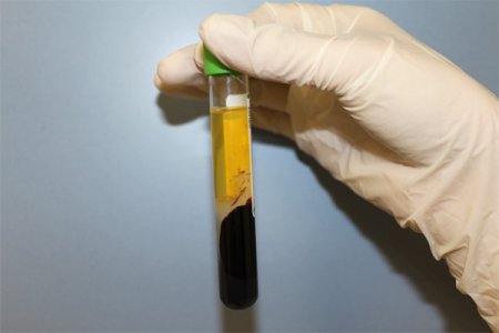 Распространённые ошибки отбора и доставки проб на биохимические исследования крови
